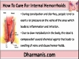 Is There A Cure For Internal Hemorrhoids Without Surgery 