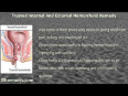 09-trusted internal and external hemorrhoid remedy