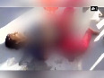 Inhumane! Onlookers click pictures as boy bleeds to death 