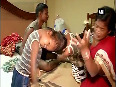 Doctors separate conjoined twins sharing head after marathon surgery