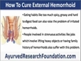 How To Cure External Hemorrhoid At Home Naturally 