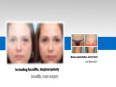 Certified Plastic Surgeon in Beverly Hills to Enhance Your Look