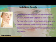 3-herbal acne remedy read