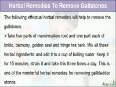 Herbal Remedies to Remove Gallstones Fast and Naturally