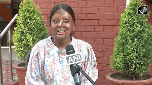 Chandigarh acid attack survivor among CBSE class 12 exam toppers, scores 96%